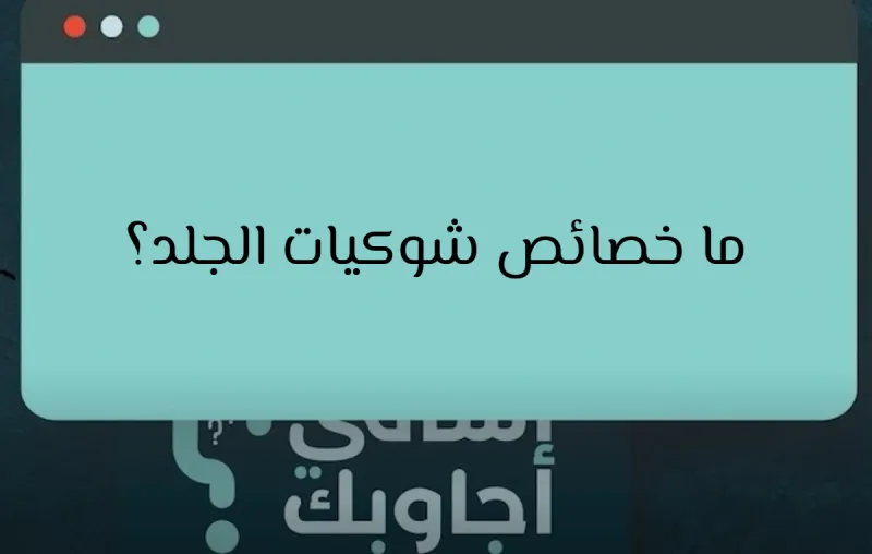ما خصائص شوكيات الجلد؟